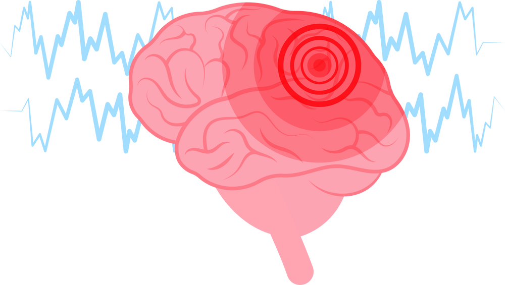 dementia depression central behaviour electrical biosignal activity mental wave health anxiety hyperactivity Traumatic concussion hemorrhage memory loss  Attention deficit hyperactivity disorder EEG